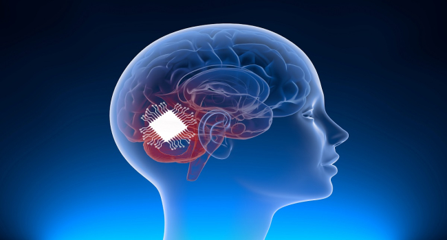 Neuralink's neurochip has been successfully implanted in the brain of first human