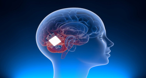 Neuralink-ի նեյրոչիպը առաջին անգամ հաջողությամբ տեղադրվել է մարդու գլխուղեղում