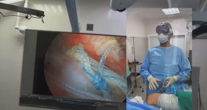 Brazilian surgeon performs operation by using Apple Vision Pro