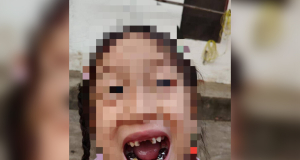 Robot knocks out teeth of five year old girl: Incident at Chinese museum leads to lengthy compensation dispute